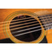 L.R. Baggs Acoustic Guitar Microphone | Lyric